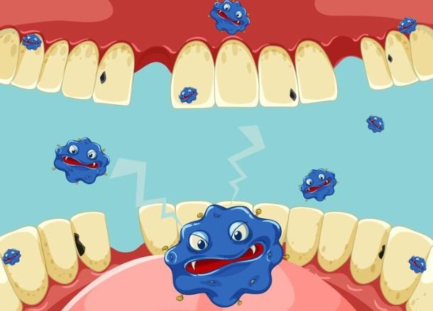 Signs and Symptoms of a Tooth Infection